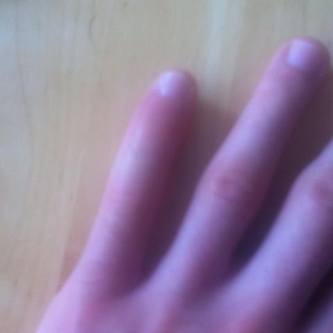 Finger verstaucht wie lange