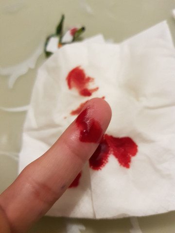 - (Finger, Basketball, Schnitt)