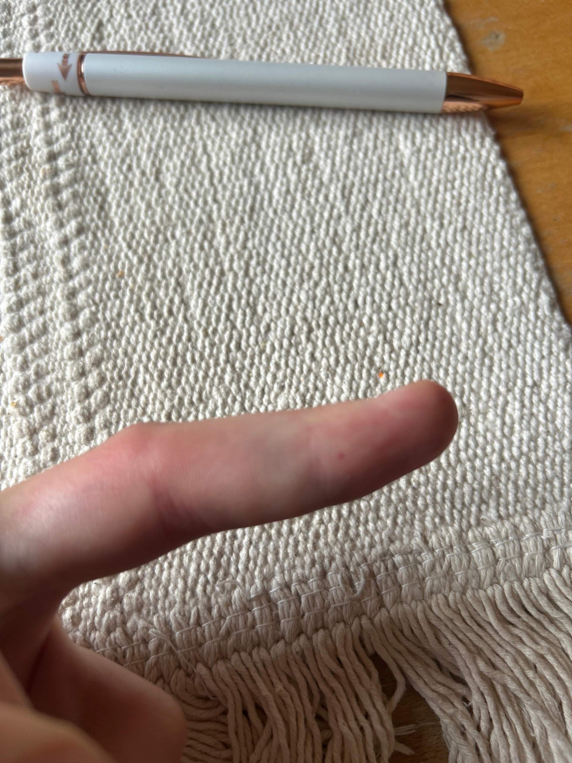 Finger gebrochen? (Schmerzen, Knochen)