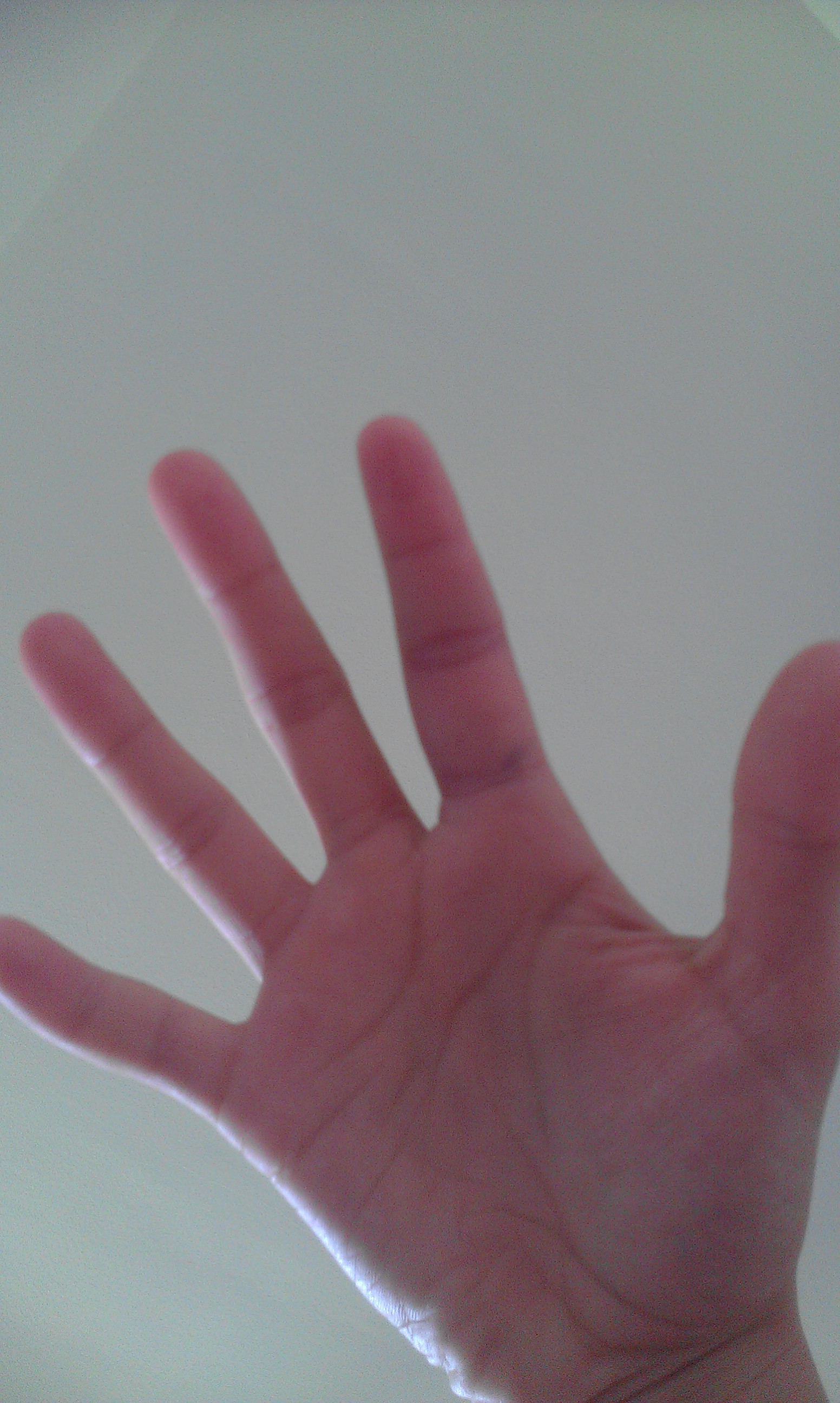 Wie Schaut Ein Gebrochener Finger Aus