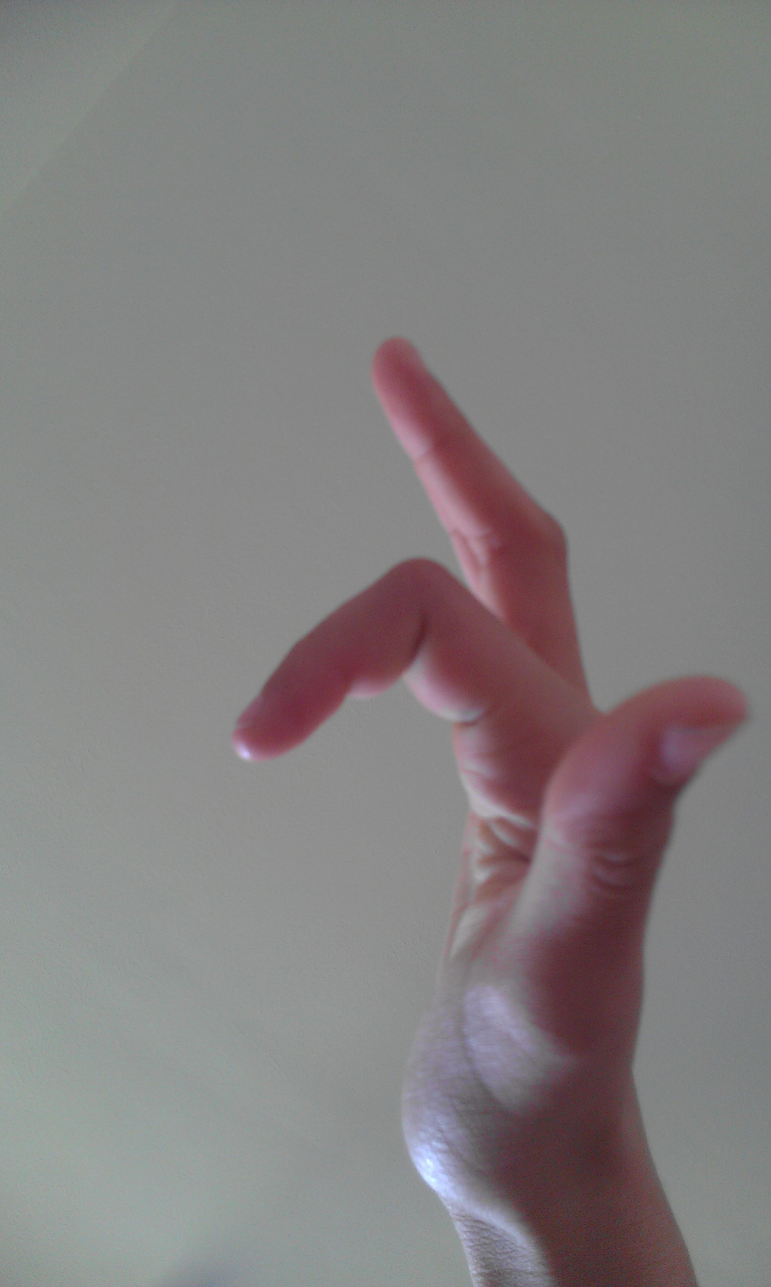Wie Sieht Ein Gebrochener Finger Aus