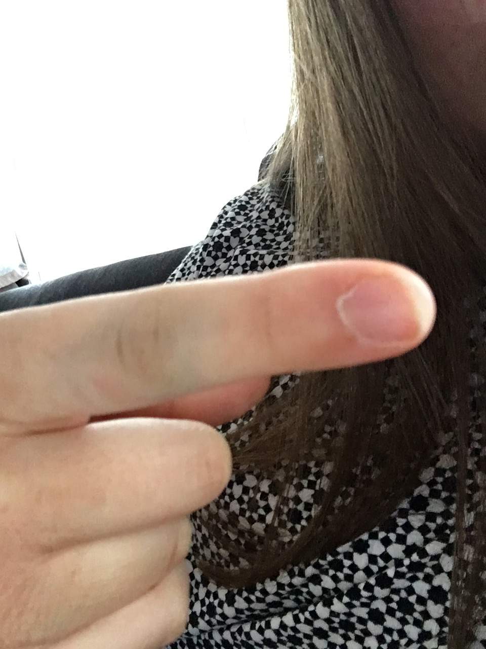 Autotür gequetscht in finger