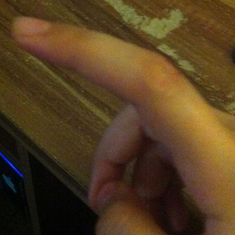 Mein rechter Zeigefinger der seit Gestern Abend teilweise Taub ist. - (Medizin, Hand, Finger)