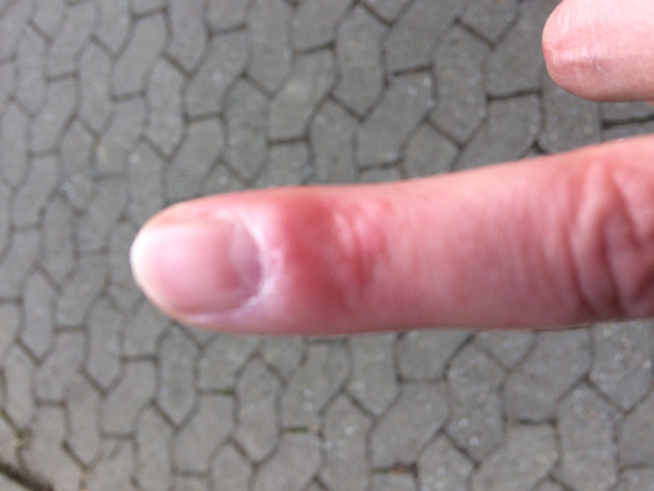 Finger 1 - (Nägel, Finger)