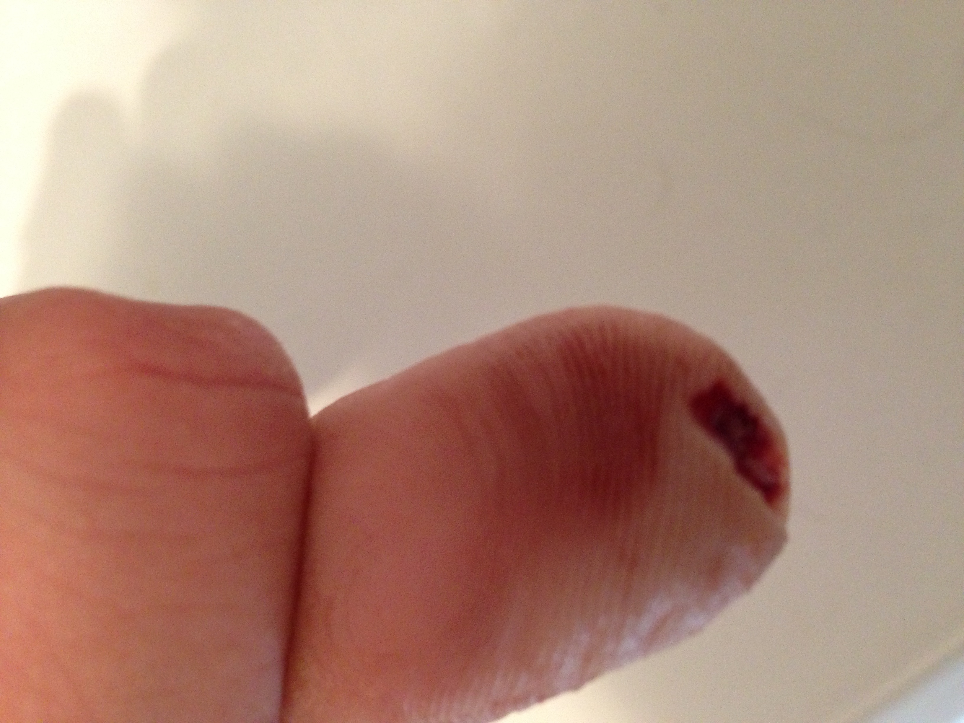 Fingerkuppe Ab Wielange Realistisch Krank Beruf Krankenpfleger Medizin Arzt Schneiden Fingerkuppe Ab Wielange Realistisch Krank Beruf Krankenpfleger Medizin Arzt Schneiden
