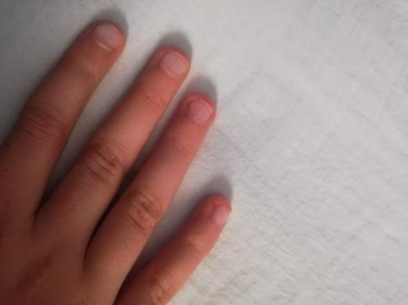 Fingernagel Kauen Abgewohen Gesundheit Und Medizin Beauty Nagel