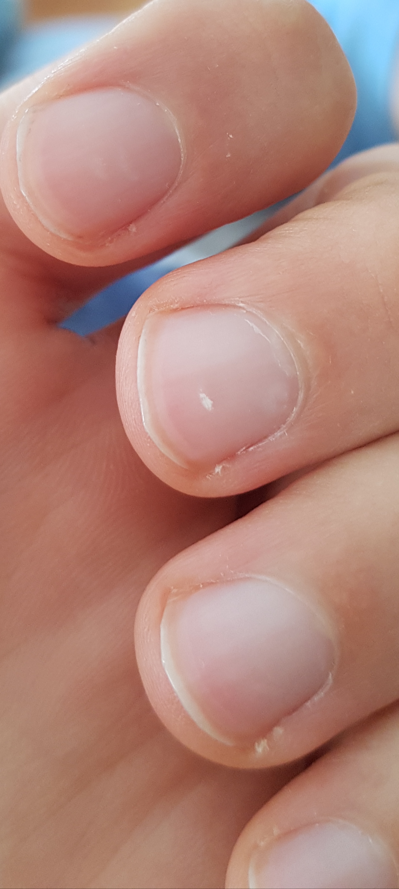 Fingernägel muss ich zum Dermatologen? Was ist das? ist das normal bei