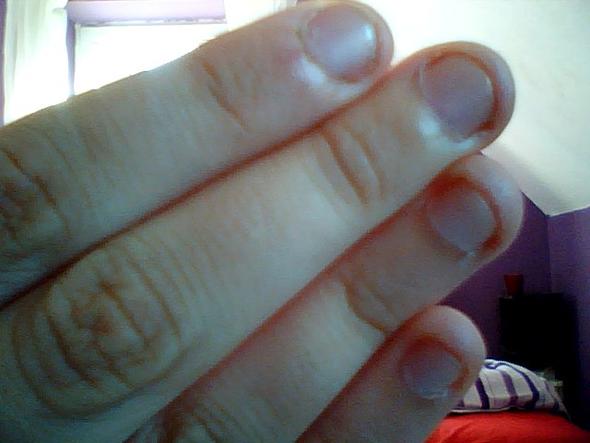 Meine Nägel - (Gesundheit, Beauty, Fingernägel)