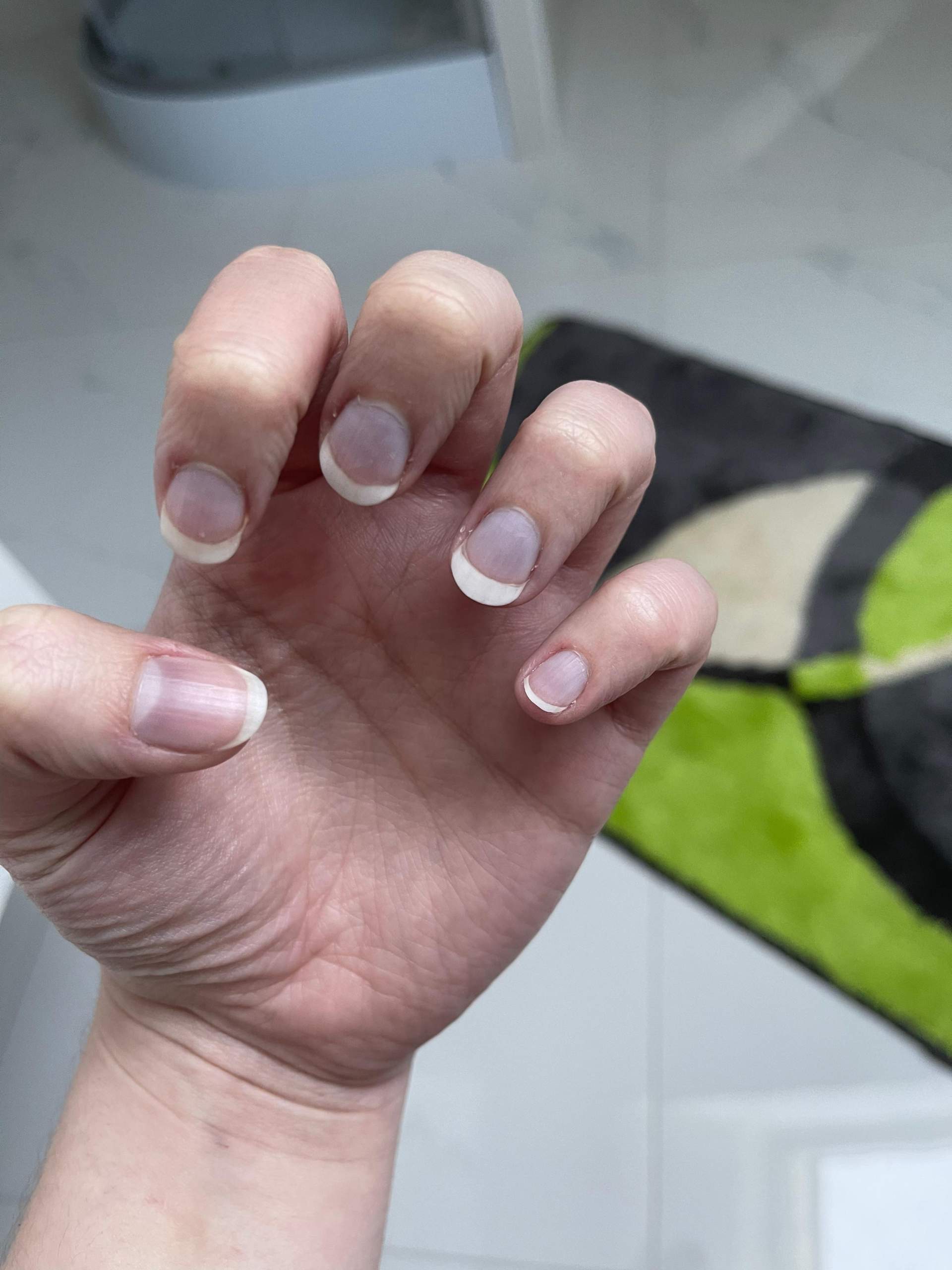 Nagelpflegeöl - Repair Serum Für Brüchige & Verfärbte Nägel | Mit Präziser Applikator-Bürste