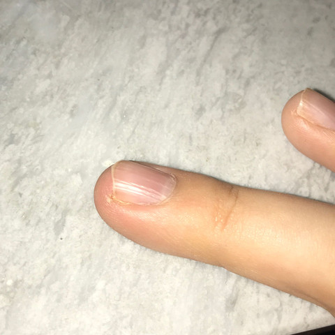 finger sticht in mein fleisch rein mein nagel an ecke es hat ein loch im fle - (Gesundheit und Medizin, Gesundheit, Schmerzen)