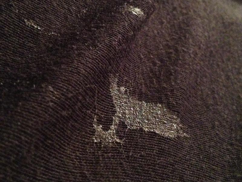 Fliegen am arsch Flecken entfernen!? wie krieg ich diesen fleck heraus? siehe bild (waschen)