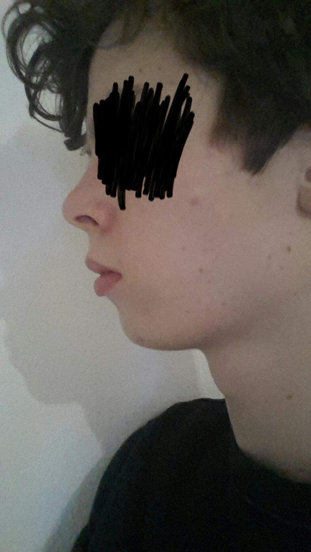 Fliehendes Kinn? (Gesundheit und Medizin, Gesundheit, Körper)