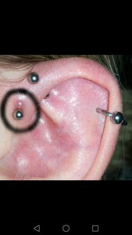 ForwardHelix - (Piercing, Helix, Wildfleisch)