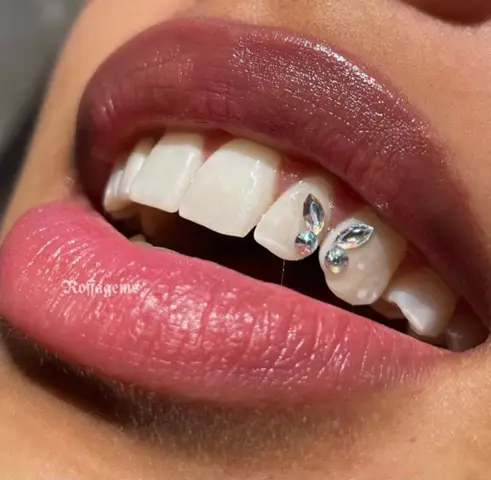 Frage an die Jungs … wie findet ihr tooth gems an Mädchen?