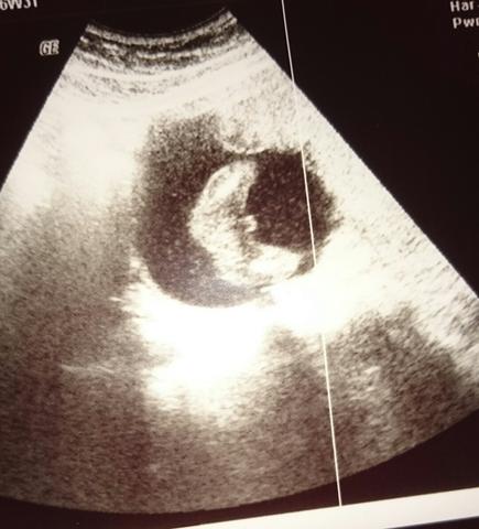 Jungfrau frauenarzt ultraschall Gynäkologische Untersuchung