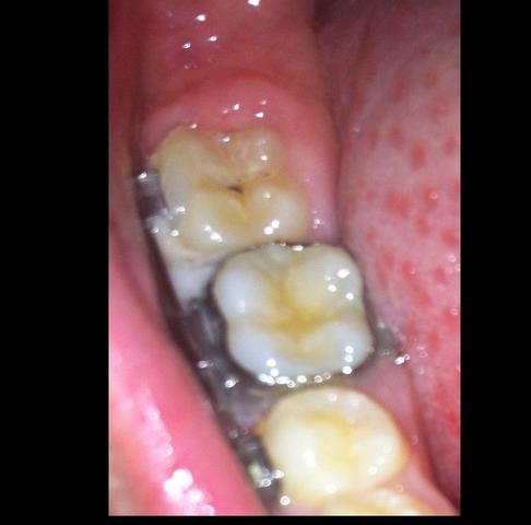 Zähne - (Arzt, Zähne, Zahnarzt)
