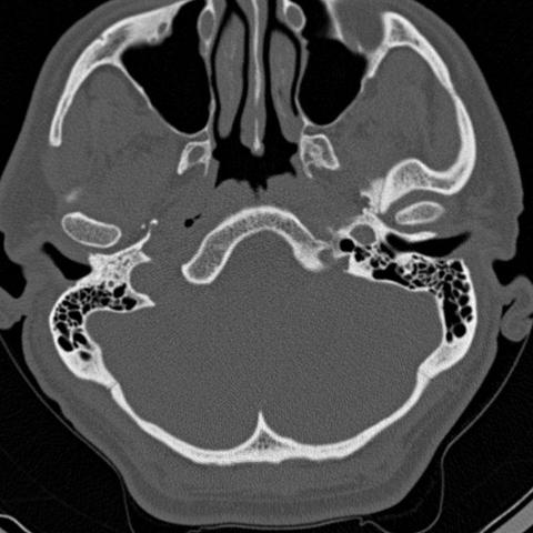 Röntgen 1 - (Kopf, Röntgen, CT)