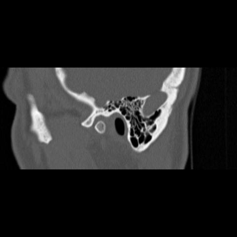 Röntgen 2 - (Kopf, Röntgen, CT)