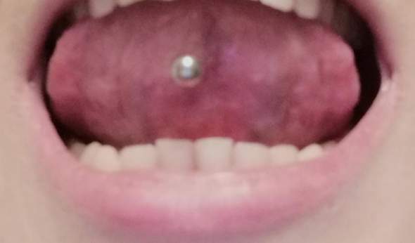 Unter zunge schmerzen zungenpiercing der Zungenpiercings