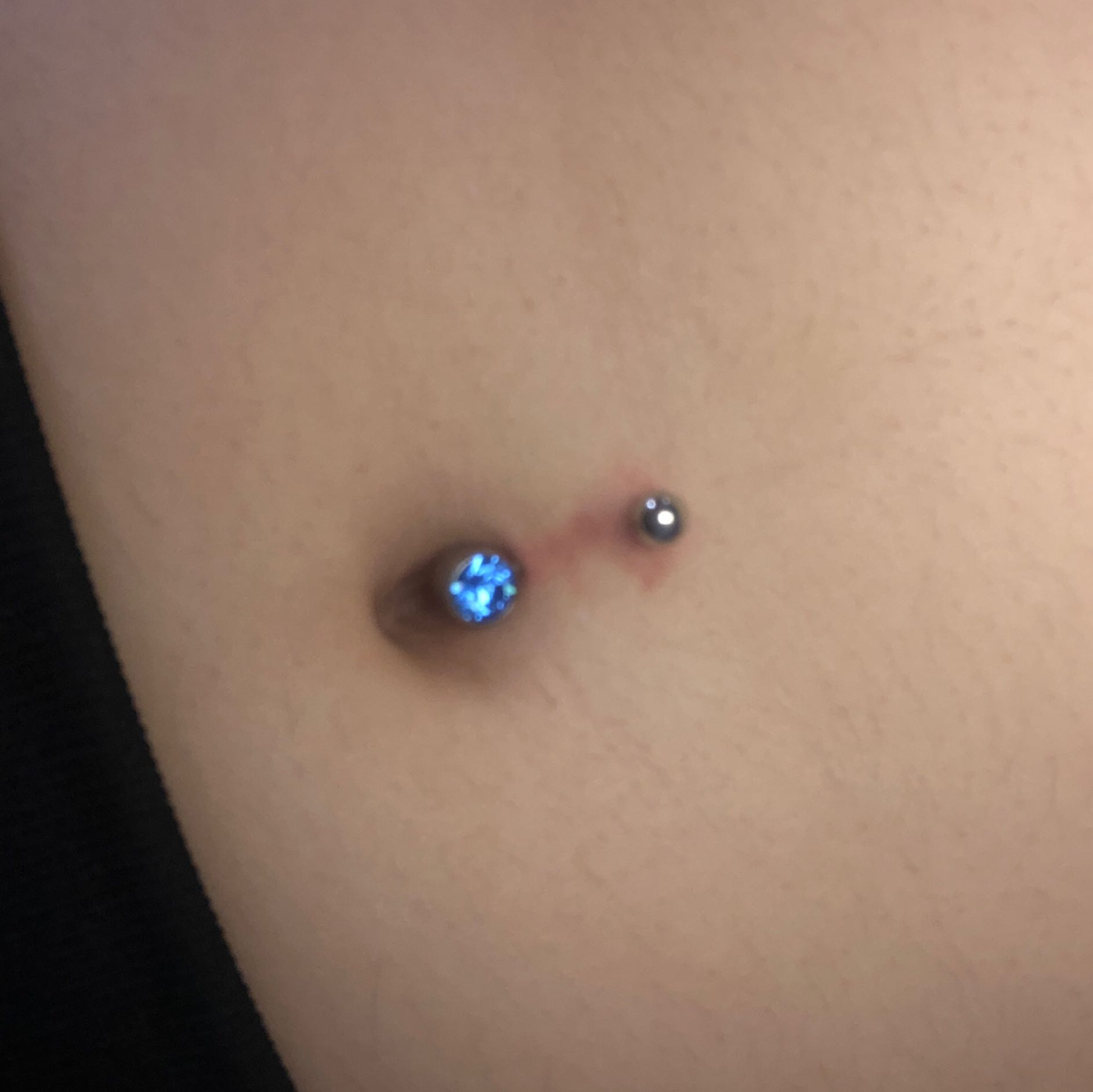 Wie Sieht Ein Entzündetes Bauchnabelpiercing Aus