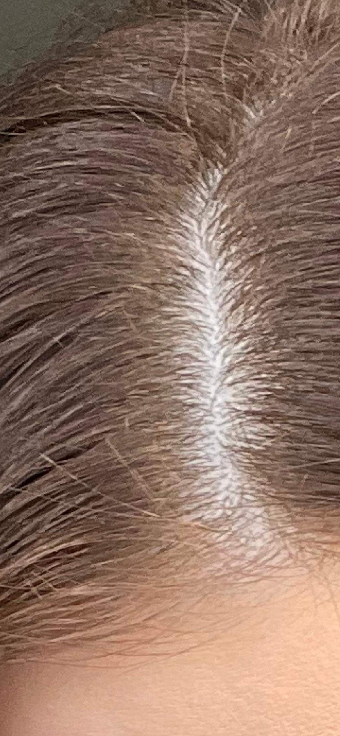 Friseur Hat Haare Zu Dunkel Gefärbt Friseurin hat Ansatz zu dunkel gefärbt kann ich es reklamieren? (Haare