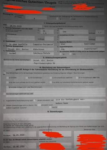 Fuhrerschein Sehtest Trotz Sehschwache Mit Arztlichem Gutachten Optiker Augenarzt Bf17 Fuhrerschein Sehtest Trotz Sehschwache Mit Arztlichem Gutachten Optiker Augenarzt Bf17