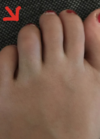 Fuß Finger  - (Schmerzen)