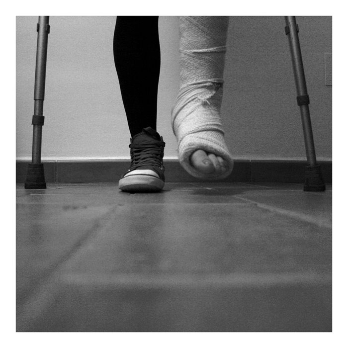 Fuss Fuhlt Sich Nach Bruch An Wie Eingeschlafen Gesundheit Laufen