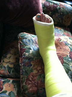 Fuss Fuhlt Sich Nach Bruch An Wie Eingeschlafen Gesundheit Laufen