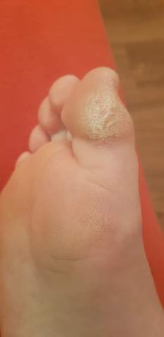 Fuss Ultra Hasslich Fur Ne Frau Fusse Komisch Fuss Ultra Hasslich Fur Ne Frau Fusse Komisch