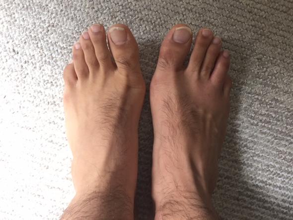 Fuß - (Medizin, Arzt, Füße)