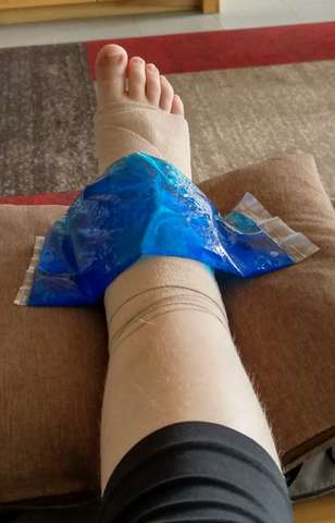 Fussgelenk Verstaucht 3 Gesundheit Und Medizin Schmerzen Fusse