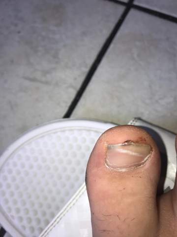 - (fußnägel, fuss-nagel)