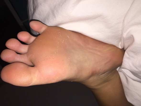 Hautpilz Die Meistgelesenen Fragen