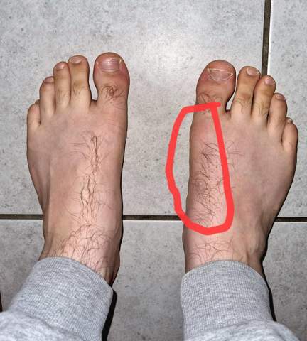 Fußschmerzen seit 3 Monaten, woran könnte es liegen?