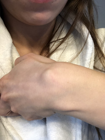 Ganglion Verschwindet Gesundheit Und Medizin Medizin Chirurgie Ganglion Verschwindet Gesundheit Und Medizin Medizin Chirurgie