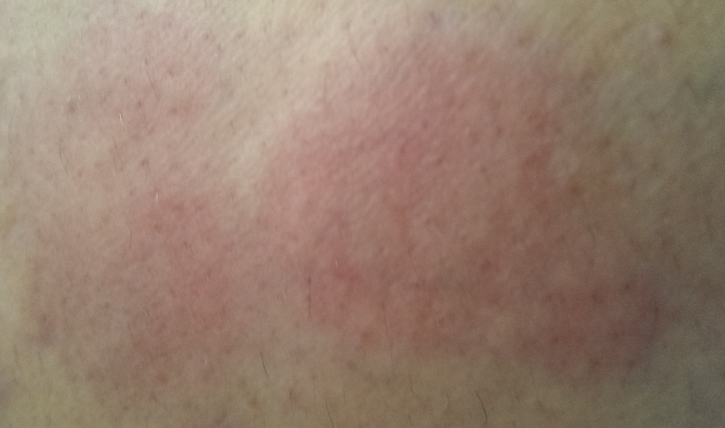 cialis professional overnight cialis professional overnight