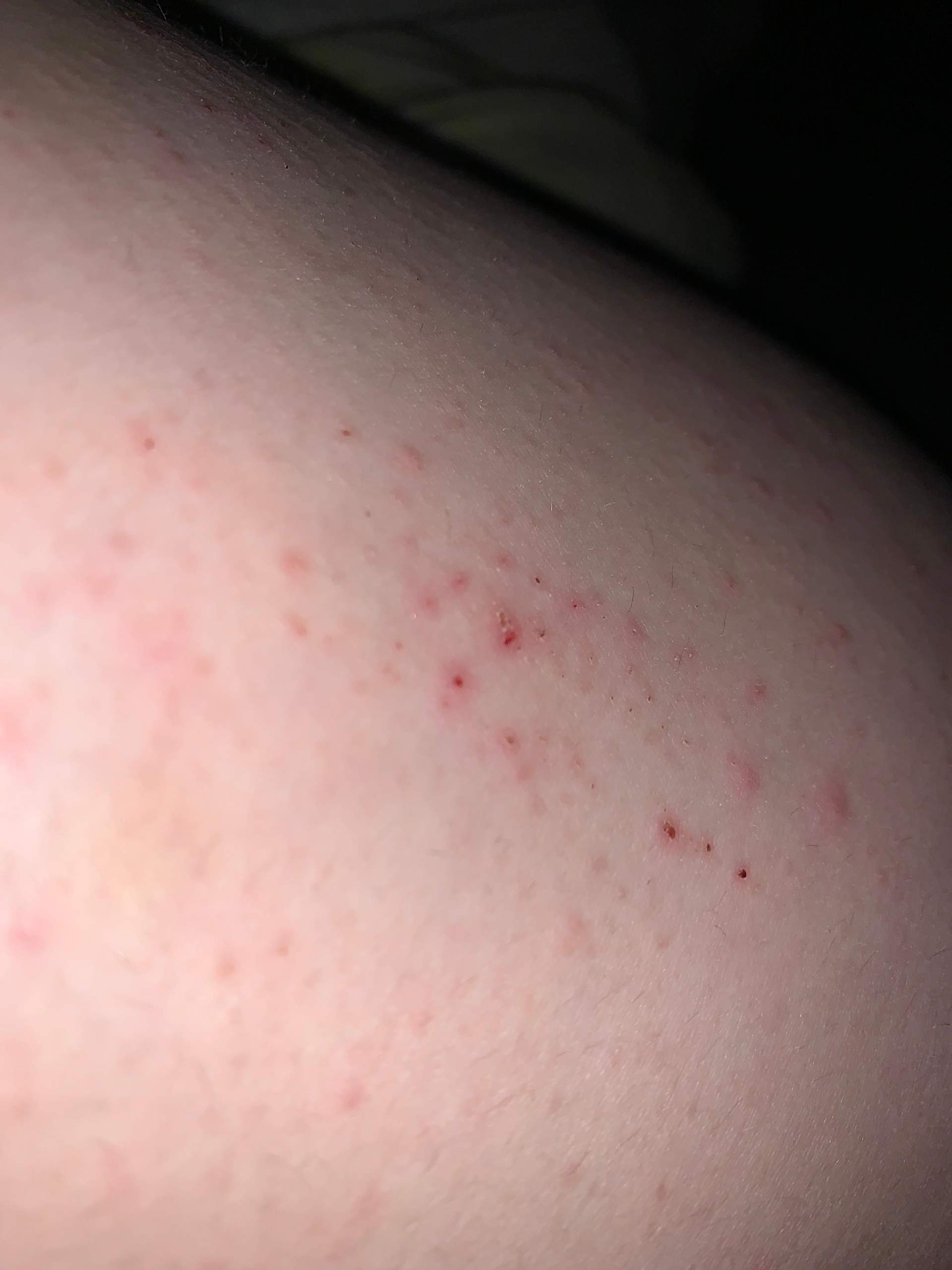 Rücken, Nacken, Hüfte, Füße du kannst die verspannten Stellen an deinem Körper kaum noch Rücken, Nacken, Hüfte, Füße du kannst die verspannten Stellen an deinem Körper kaum noch