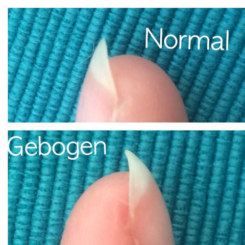 Fingernägel im Vergleich  - (Nägel, Finger)