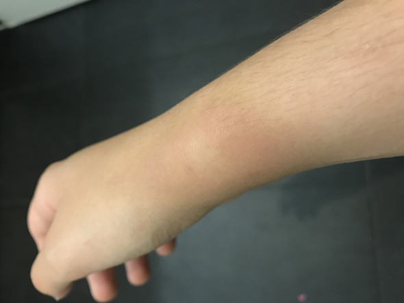 Bild 1 - (Gesundheit, Schmerzen, rechte Hand)