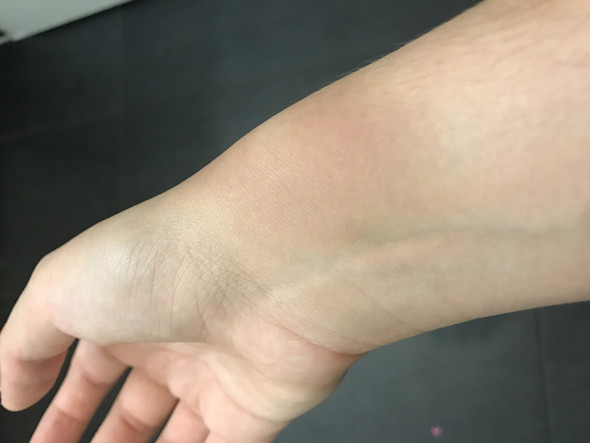 Bild 2 - (Gesundheit, Schmerzen, rechte Hand)