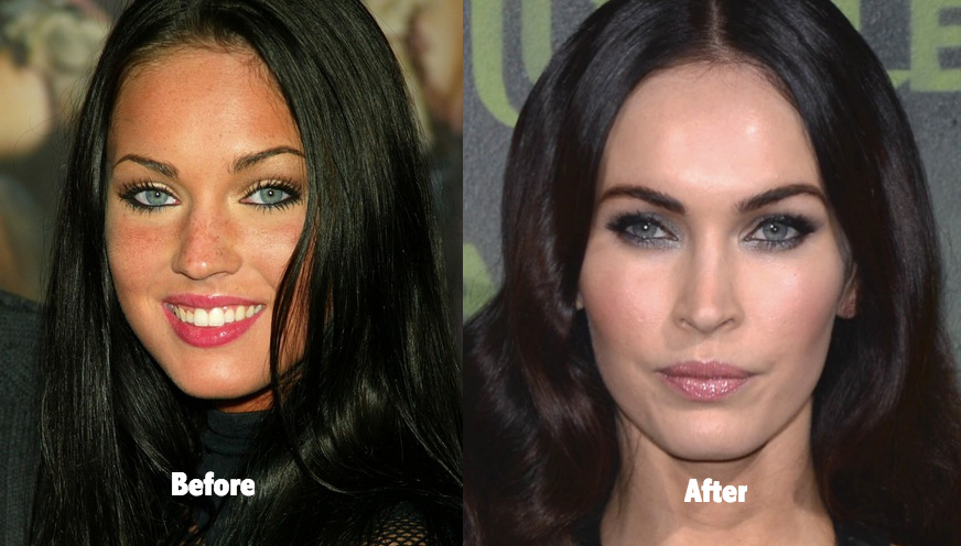 Gefällt euch Megan Fox besser vor oder nach ihrem plastisch