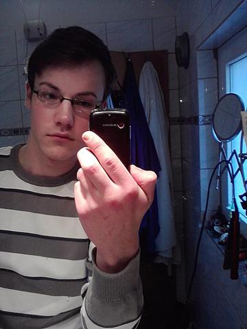 Geheimratsecken Hohe Stirn Ich Weiss Nicht Mehr Weiter Haare Korper Aussehen