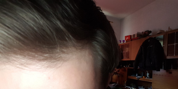 medizin haare frisur