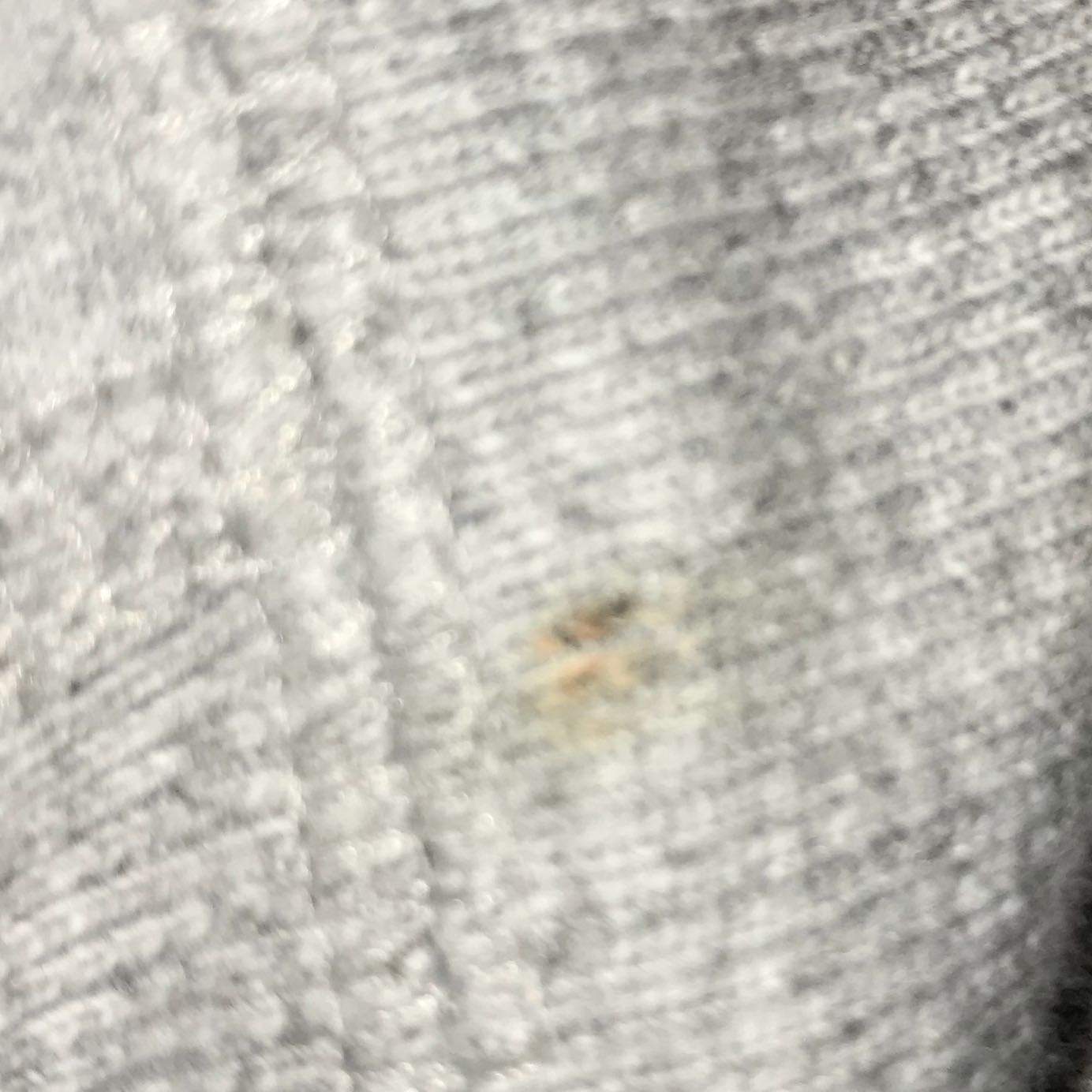 Geht Blut aus Kleidung raus und wie? (Gesundheit und Medizin, Flecken, entfernen)