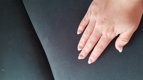 Gel Nägel Stehen Ab Nagellack Professionell