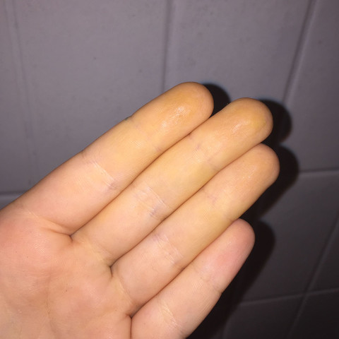 Gelbe Finger innen und anderes Gefühl - (Gesundheit, Finger, gelb)