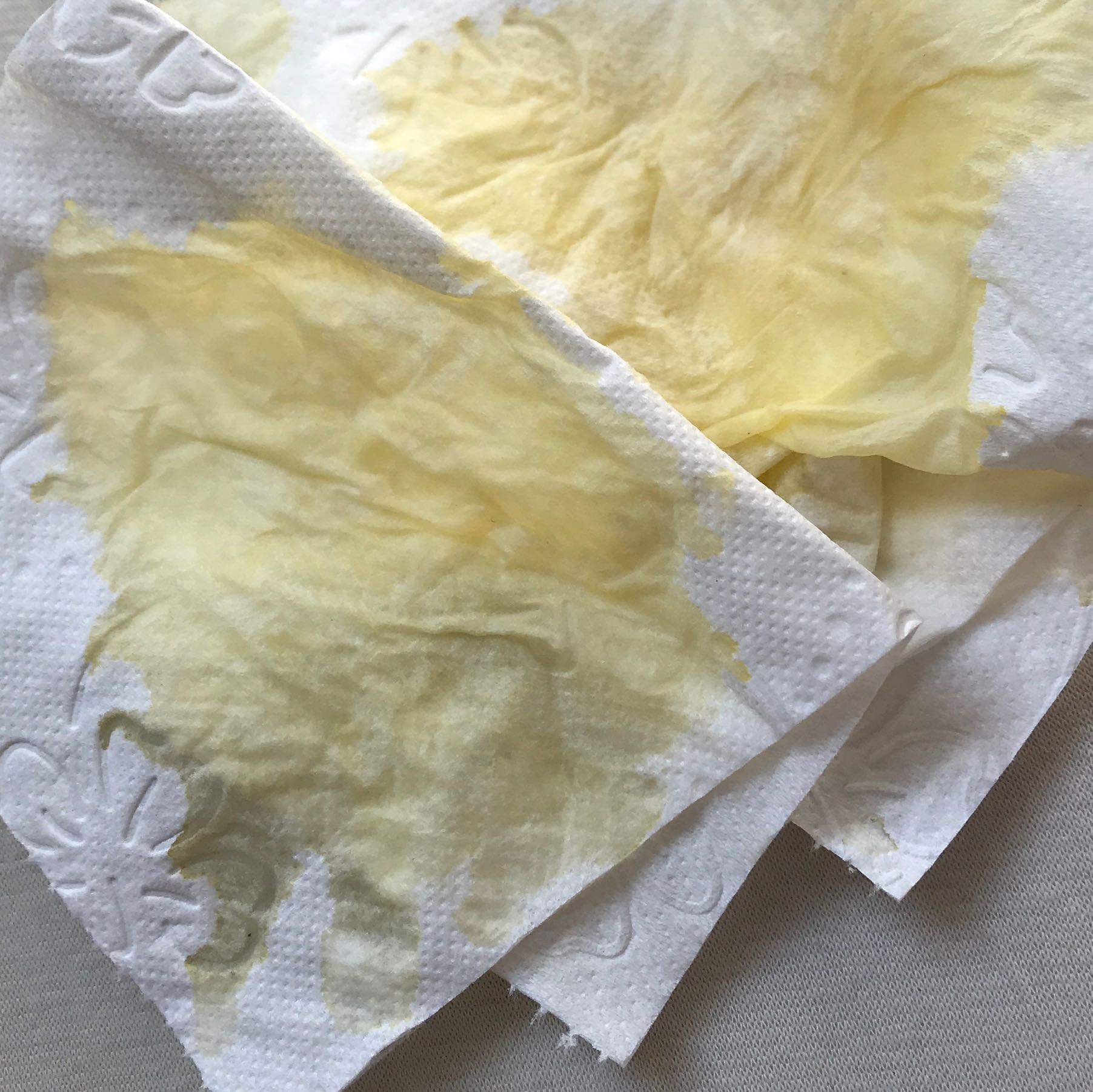 Gelbe Flussigkeit Kommt Aus Der Nase Gesundheit Und Medizin Gesundheit Arzt Gelbe Flussigkeit Kommt Aus Der Nase Gesundheit Und Medizin Gesundheit Arzt