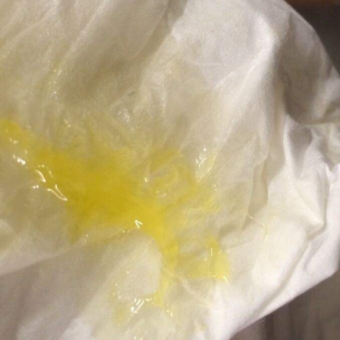 Gelbe Flüssigkeit läuft aus der Nase? (gelb)