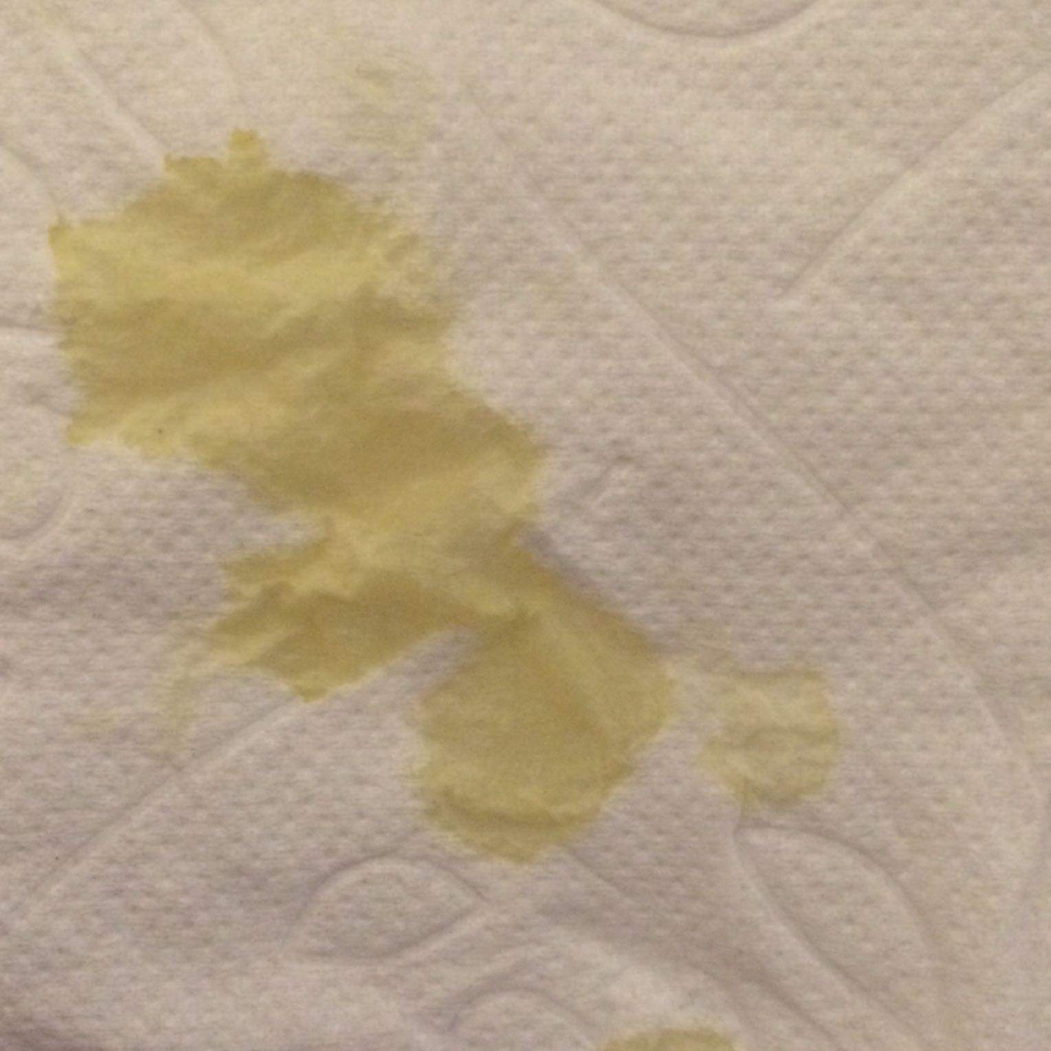 Gelbe Flüssigkeit läuft aus der Nase? (gelb)